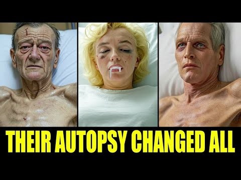 15 Celebrity Autopsy Reports That Shocked the Entire Hollywood!