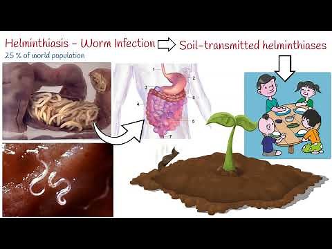 Helminthiasis - 3 Most Common Parasitic Worms: Ascaris; Whipworm; Hookworm
