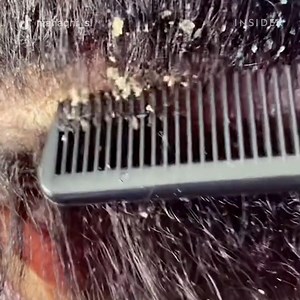 Felicia Brown's scalp cleanse is supposed to free her clients from dandruff and buildup and get their scalp and hair healthy. | Insider Beauty