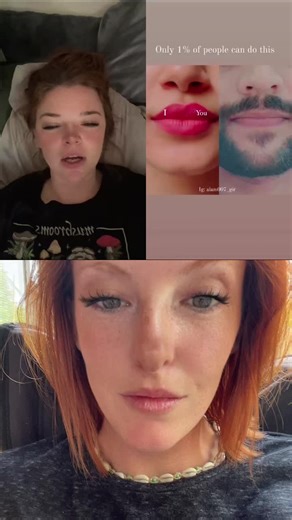 #duet with @freckledhobo #Duet damn #nowifeelbad #noheartlips #freckles #redhead #redhair