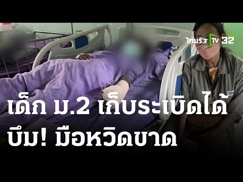 นร.เจอระเบิด เก็บส่ง ผญบ. แต่ บึม! มือหวิดขาด | 18 ก.ค. 66 | ข่าวเช้าหัวเขียว