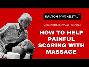 How to Help Painful Scarring with Massage