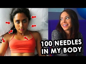 TRYING EXTREME ACUPUNCTURE (100 NEEDLES!!!) with ElloSteph