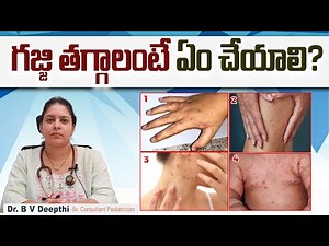 గజ్జి ఎందుకు వస్తుంది? || How to Cure Scabies at Home || Gajji Home Remedies || Sankhya Hospitals