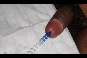 Urethral spiral removing fun 2020-03-21