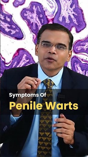 Symptoms Of Penile Warts #penis #foreskin #sexual #couples #STD #HIV #HPV #drashok #udumalpet