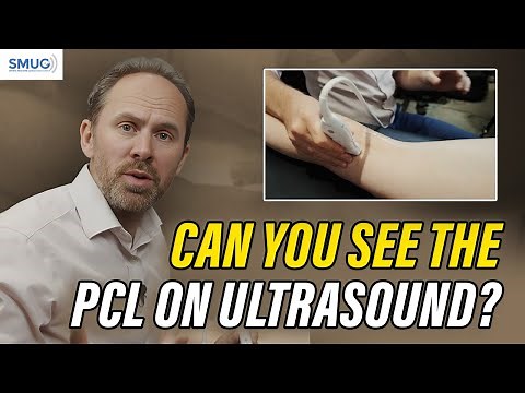PCL Ultrasound Imaging: How to Identify and Assess the Posterior Cruciate Ligament