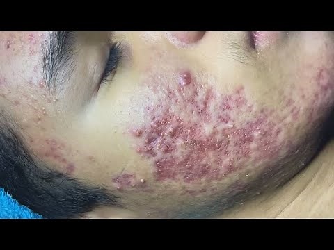 Enjoy Your Day with HANA Spa Clinic #07