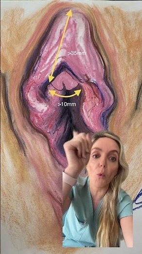 Is the Clitoris too big?