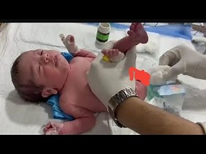 Immediate Relief of Abdominal Distension in Newborn | Suppository Technique