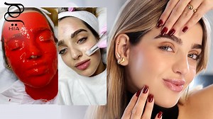 ما هو الـ Micro-needling وفوائده للبشرة؟ نجلا تخبرنا عن تجربتها اليوم مع الـ Micro-needling 🤩👇 #Microneedling | Hia Magazine