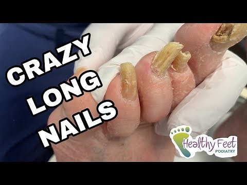 Crazy Long Thick Nails
