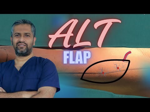 ALT Flap: The "Workhorse" of Microvascular Reconstructive Surgery. Flap surgery. 4K