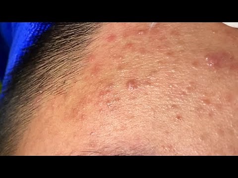 Relax Every Day With Linh Mun Spa #1