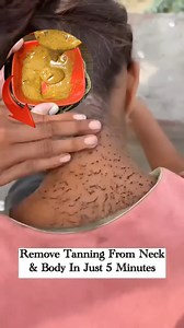 355K views · 1.8K reactions | Dark & Dirty Neck/Feet Cleaning Tips | Get Fair Neck/Remove Neck/Feet Tanning . . . #darkneck #dirtyneckcleaning #instantfairfeet #tanremoval #skincareroutine #fypシ゚viralシfypシ゚viralシalシ #fbreelsfypシ゚viral #fbreelsvideo #fbreelsfypシ゚viralvideo #explorepage #fblifestyle | Simple Home Remedies | Facebook