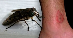 What you should do if you get bitten by a horsefly