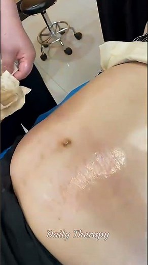 Trapped Gas Gone in Minutes With This Massage #massage #pain relief #technique