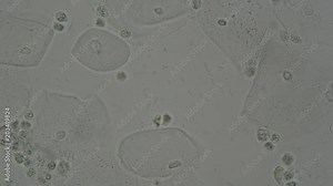 wet smear from vagina swab show epithelium cell , white blood cell and bacteria under microscope