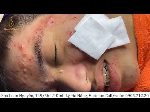 Beauty for everyone is what I like (227) | Loan Nguyen