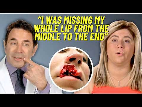 Karissa’s Unbelievable Transformation After Losing Half Her Lips in Dog Attack | Botched | E!