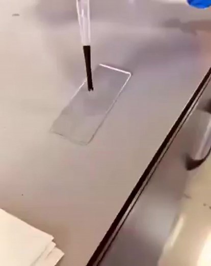 Lactophenol Blue Staining in Mycology: Then vs Now Back in the day, we poured the stain and teased out fungal growth until it looked just right. Now? A simple cellophane tape press gets it done — faster, cleaner, and with better detail? Old school taught us skill. New school adds speed. | Medlab HQ