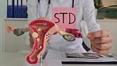 Model of female reproductive system and suppository medical tablet....