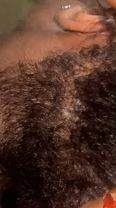 #ASMRScalpScratch #DandruffLift #SatisfyingVideos #RelaxingASMR #ScalpCare #StressRelief #ASMRCommunity #SelfCareVibes #ASMRUSA #RelaxationTherapy #DandruffScratch #CalmMind | Swati Singh