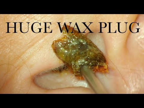 HUGE WAX PLUG : COLACE TO THE RESCUE : 4K/HD
