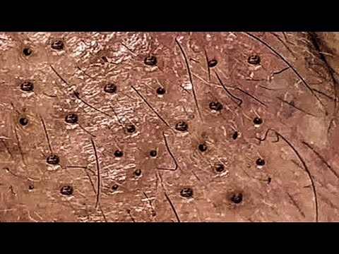 Satisfying With Loan Nguyen Spa Video #010