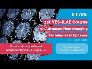 5th Lecture Voxel-Based Morphometry using Statistical Parametric Mapping