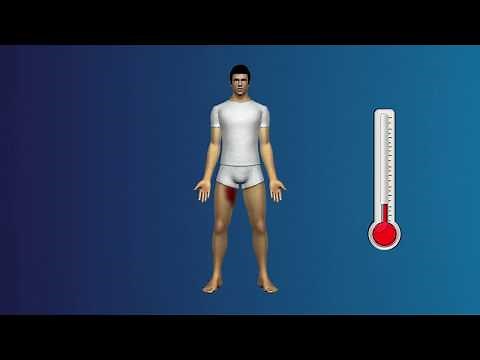 JOCK ITCH- SYMPTOMS, CAUSES AND CURE