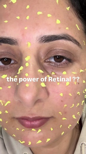 Dot it On✨✨ @KSECRET GLOBAL Seoul 1988 Advance Shot : Retinal Liposome 12% Black Rice #ksecret #seoul1988 #retinal #shot #wrinklecare