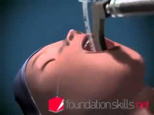 Animasi Prosedur Intubasi Endotrakeal Tube