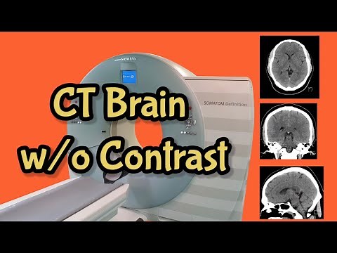 CT Brain without Contrast