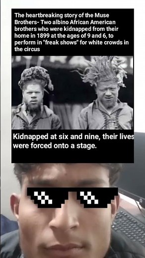 The Heartbreaking Story of the Muse Brothers 🎪 | Kidnapped & Exploited in Circus ‘Freak Shows