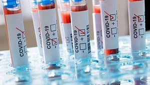 COVID-19: 779 health workers infected, nine dead, many others in isolation