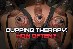 How Often to Perform Cupping Therapy (If You Want The Best Results) - Strength Resurgence