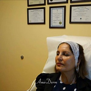  Dr. Jafari explains Botox treatments around the mouth and jawline...