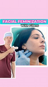 Want a softer, more feminine look, without surgery? Facial feminization with dermal fillers is a subtle but powerful way to enhance your lips, jawline, chin, and cheekbones. It’s a personalized, non-invasive treatment that will help you look and feel like the best version of yourself. Don't worry it's not high maintenance, its results last for over a year. #FacialFeminization #Fillers #PlasticSurgery #NYC | Dr. John Mesa