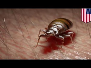 Worst bed bug infestation ever found in Maryland home - TomoNews