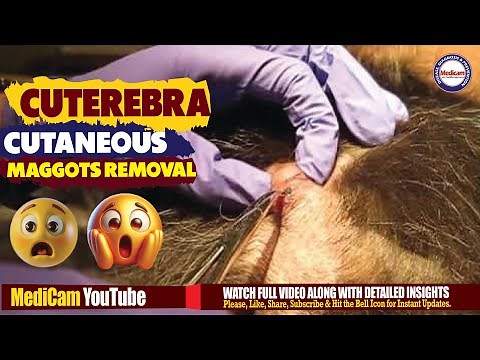 Cutaneous Cuterebra Maggot Myiasis: Live Removal & Extraction