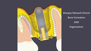 Sinus Floor Elevation Grafts: How do They Actually Work? Part I