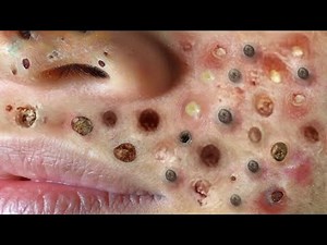 Relax every day with Mai Ngoc Spa New Video #16