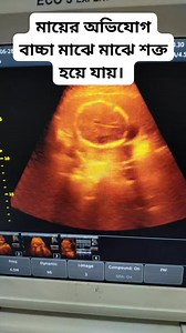 #pregnancy_usg | Dr.Sharmin Popy