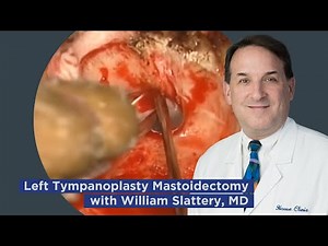 Left Tympanoplasty Mastoidectomy by William Slattery, MD