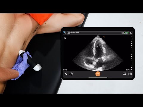 The Apical 4 chamber Cardiac View