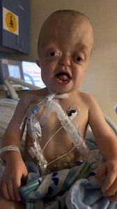 66K views · 10K reactions | Raedyn was telling all of the nurses before surgery his name and age  he vocally tries to say Raedyn, and signs “R” along with saying “4” he has come so far and I cannot wait to see all of the things he continued to do! #risewithraedyn #pfeiffersyndrome #craniosynostosis #trachbabies #surgery #morealikethandifferent #craniofacialdifference | Risewithraedyn | Facebook