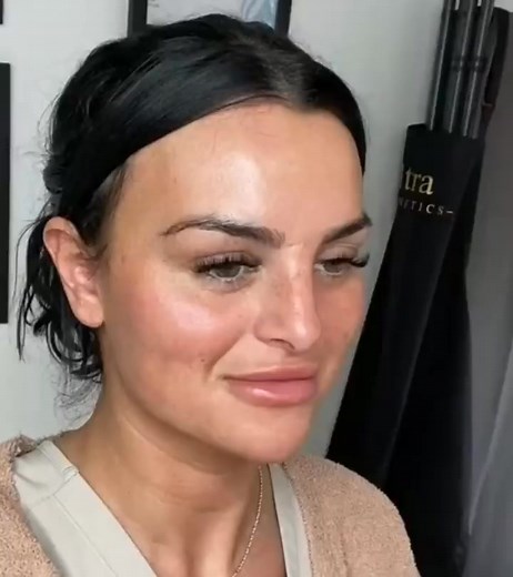 🚨 Hello Sherwood Park & Surrounding Areas 🚨 Smooth Skin. Youthful Glow. Confidence Boost. Get our Botox Beauty Package with 20 units of Botox for only $159! This is perfect for anyone who: 👉 Wants to reduce fine lines and wrinkles 👉 Is starting to notice frown lines or crow’s feet 👉 Wants a refreshed, natural look without surgery Our expert injector customizes each treatment to: ✨ Soften expression lines and prevent deeper wrinkles ✨ Smooth forehead, brows, and around the eyes ✨ Restore a y