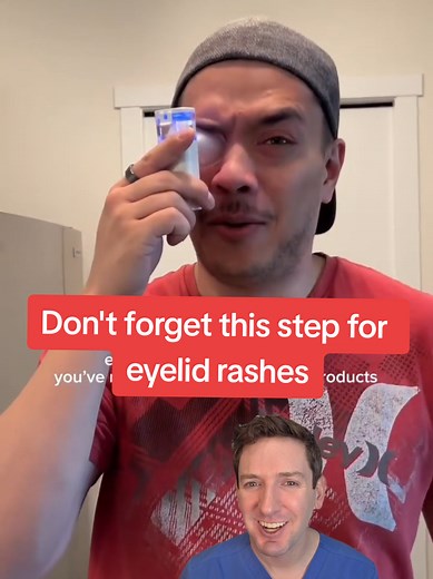 Stitch w/@jenavielovett Don't forget this step when dealing with chronic eyelid dermatitis! #eyeliddermatitis #derm #eyelid #dermatitis #eczema