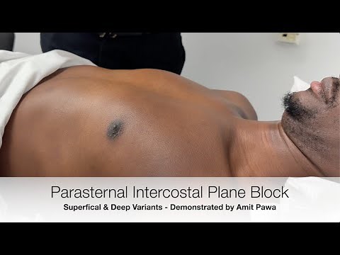 Parasternal Intercostal Plane Block